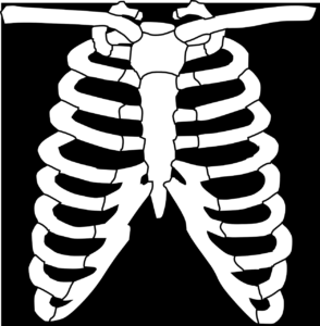 ribs, skeleton, human-309991.jpg